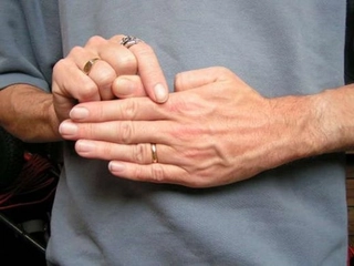 Baş Parmak Çıkığı Baş Parmağı Çıkığı Tedavisi